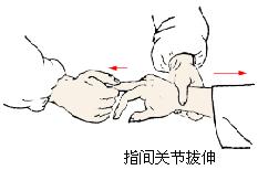指间关节拔伸法