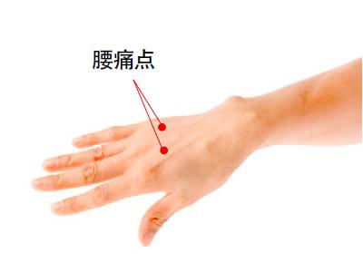 腰痛点